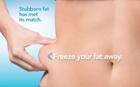 Hips treatment Wakefield From Lipo Sculpt