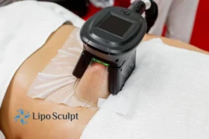 Are The Results From Aqualyx Permanent? 4 Compare Aqualyx Wakefield to other fat reduction treatments.