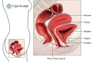 Treatment For A Leaky Bladder 2 How EM Chair treatment Wakefield can help Leaky bladder issues. Read more now!