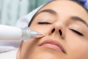 Best Actinic Keratoses Removal 3 Actinic keratoses Wakefield solutions - book in today!